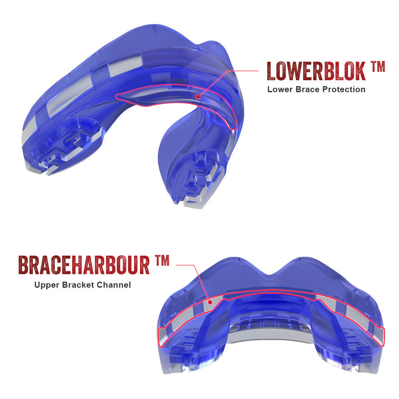 SAFEJAWZ Ortho Series Self-Fit Mouthguard for Braces - blue